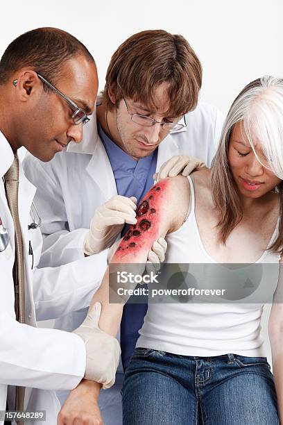 Medical Team Examining Burn Victim Stock Photo - Download Image Now - Care, Doctor, Group Of People