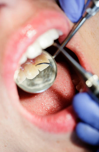 istock Dental Cleaning Close-up 157681117