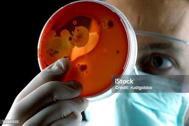 Haemoliticum 박테리아 연쇄상구균에 대한 스톡 사진 및 기타 이미지 - 연쇄상구균, 검정색 배경, 군체