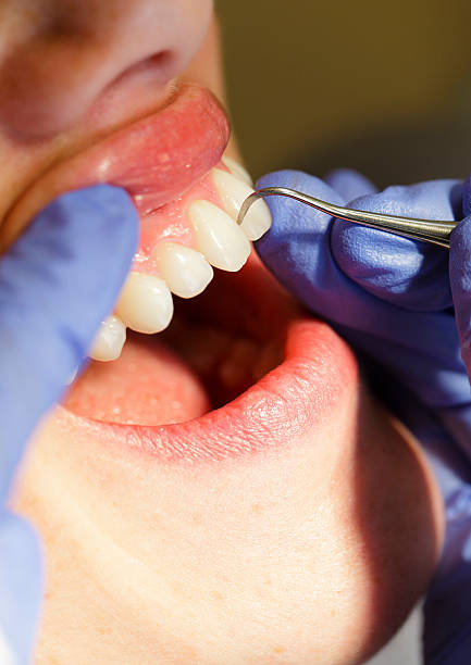 istock Dental Cleaning Close-up 157683544