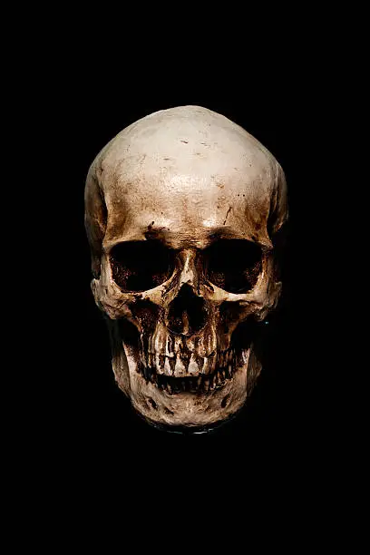 Photo of skull