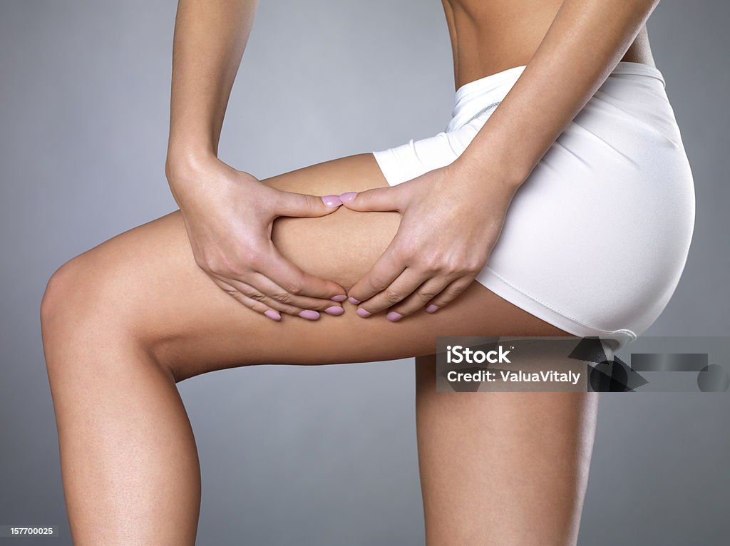 cellulite skin on her legs Female squeezes cellulite skin on her legs - close-up shot on white background Cellulite Stock Photo