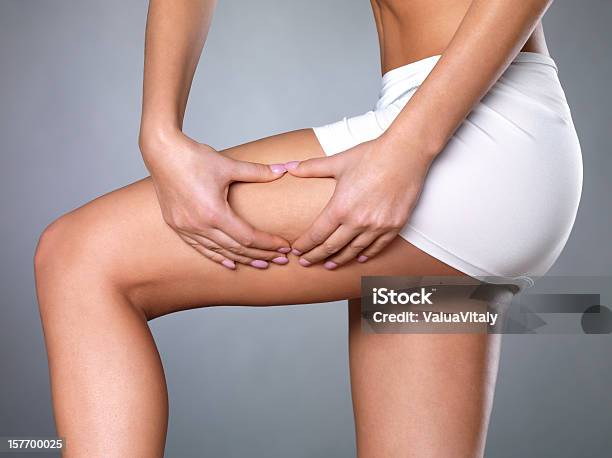 Cellulite Skin On Her Legs Stock Photo - Download Image Now - Cellulite, Thigh - Human Leg, Women