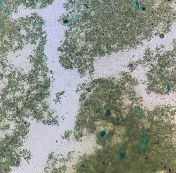 istock trichuris trichiura egg human parasite in stool or faeces examination test find microscope 1577010553