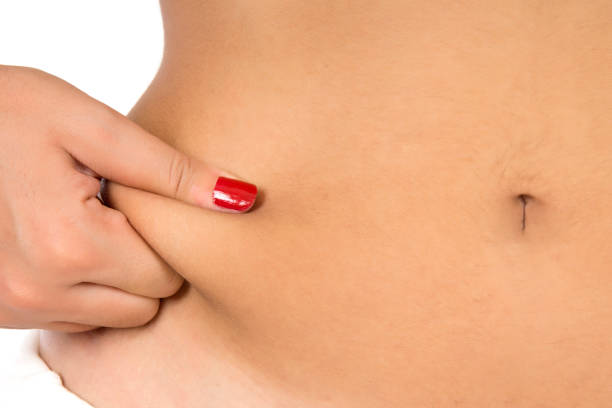 fat bauch - overweight tummy tuck abdomen body stock-fotos und bilder