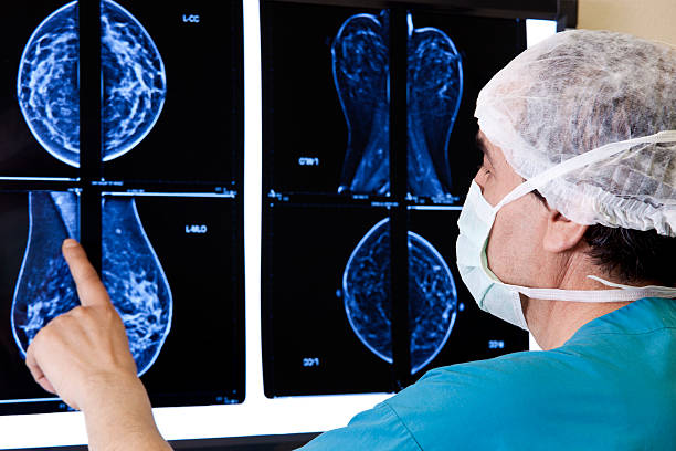 doktor blick magnetresonanztomographie - mammogram mri scan breast breast examination stock-fotos und bilder