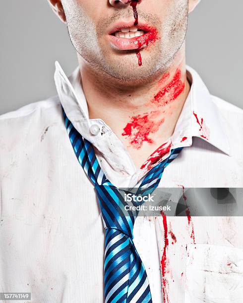 Injured Businessman Stock Photo - Download Image Now - 25-29 Years, Adult, Adults Only