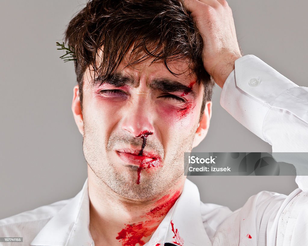 Beaten man Portrait of young injured man touching his head. Damaged Stock Photo