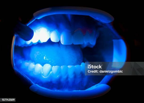Photo libre de droit de Soins Dentaire banque d'images et plus d'images libres de droit de Laser - Laser, Rayon laser, Blanchiment des dents