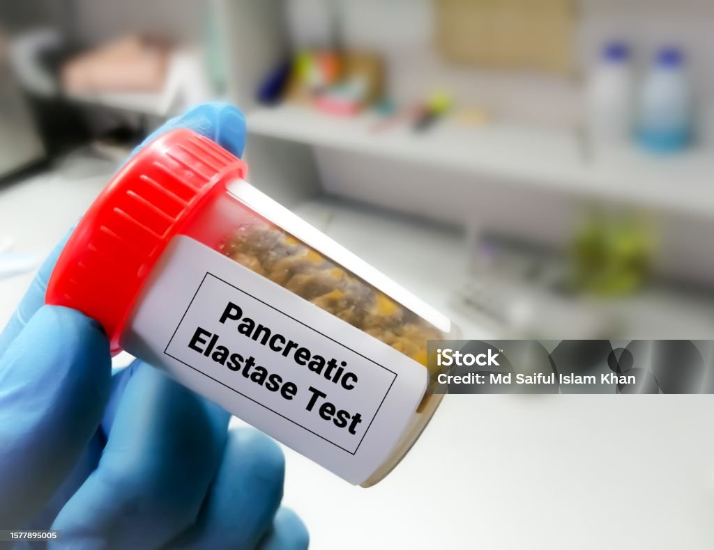 Pancrease Inefficiency Stool Fecal Elastase Test This Test Measures The Level Of Elastase An Enzyme ...