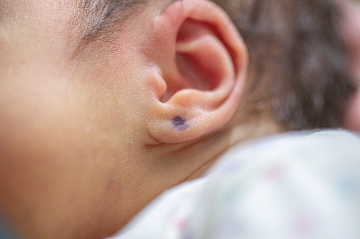 Piercing a newborn's ear to put an earring