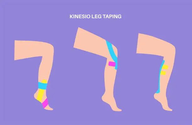 Vector illustration of Kinesiology therapeutic tape