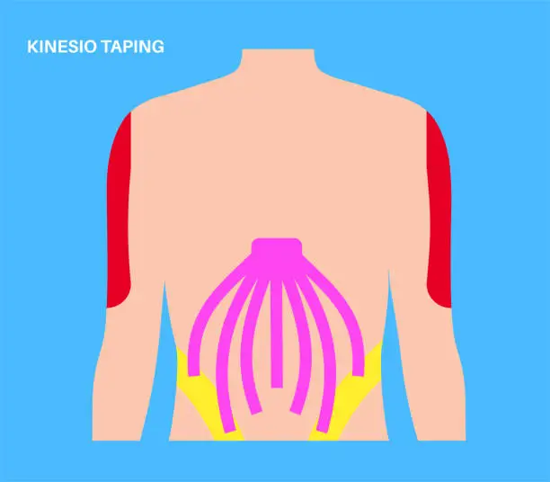 Vector illustration of Kinesiology therapeutic tape