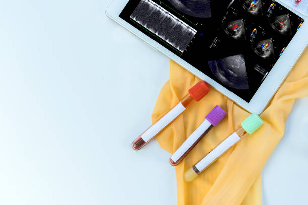 istock Patient cardiac activity is being monitored on an electrocardiogram ECG chart by doctor using digital tablet. 1581838058