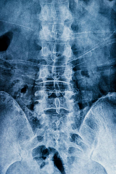 x 線 - x ray human neck animal spine human spine ストックフォトと画像