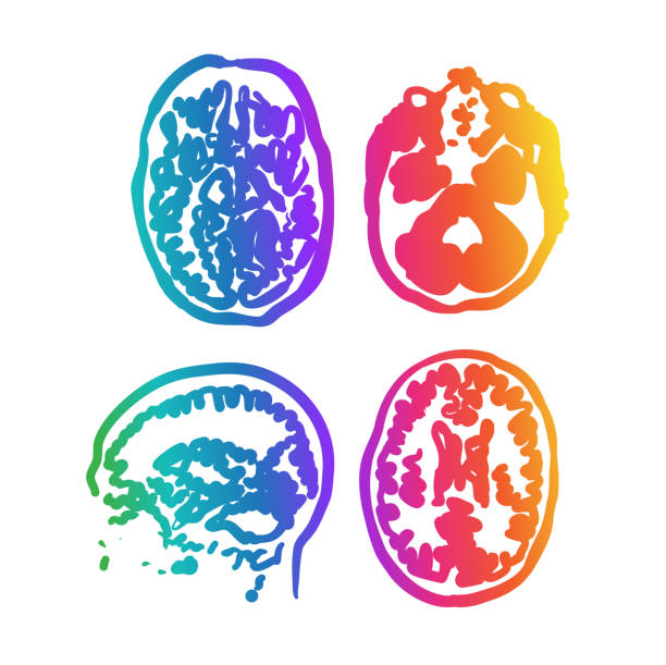 illustrazioni stock, clip art, cartoni animati e icone di tendenza di immagine di scansione cerebrale arcobaleno - commozione cerebrale