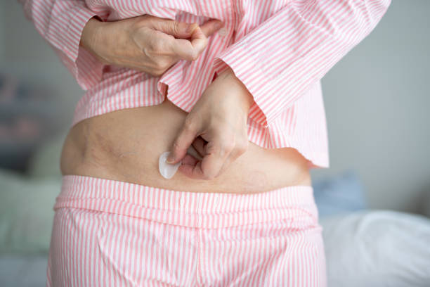 istock Abdomen of Asian woman. Applying hormone replacement patch 1582765964