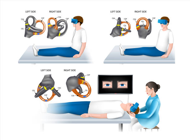 illustrations, cliparts, dessins animés et icônes de test général dix-hallpike avec lunettes - scientific imaging technique illustrations