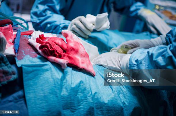 Эффектные Кардиохирургия — стоковые фотографии и другие картинки Сердечный клапан - Сердечный клапан, Кардиохирургия, Кровь