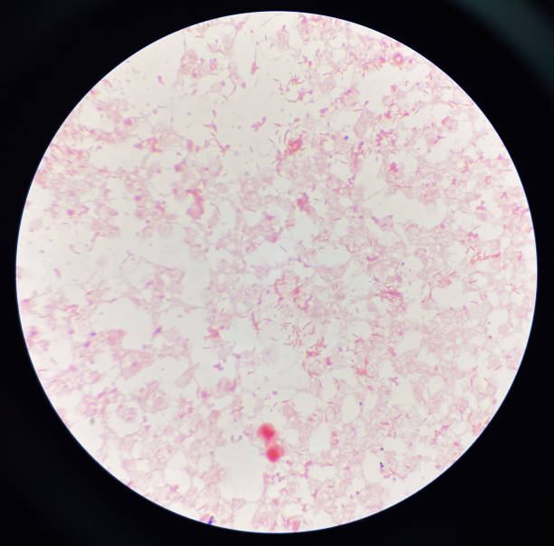 istock Gram negative bacilli in hemo culture. 1584359044