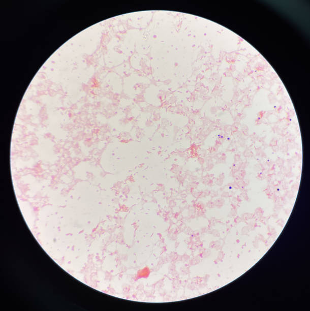 istock Gram negative bacilli in hemo culture. 1584359045