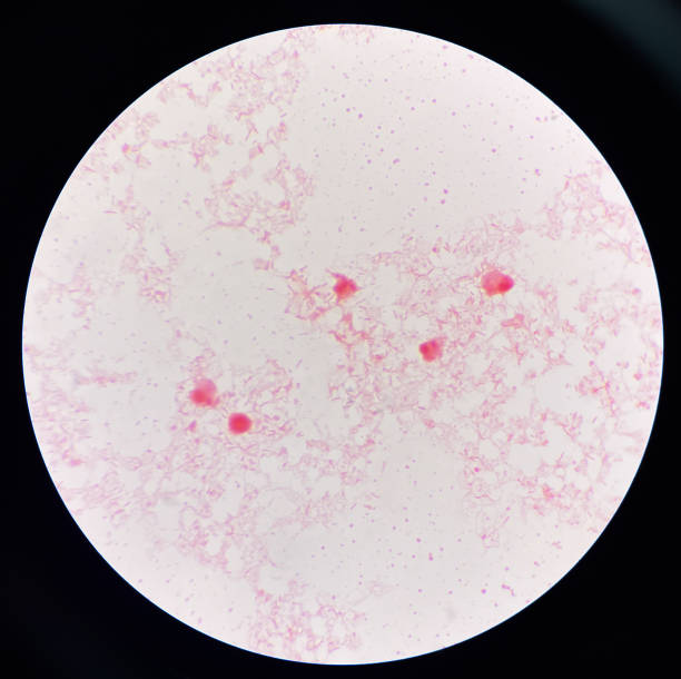istock Gram negative bacilli in hemo culture. 1584359047