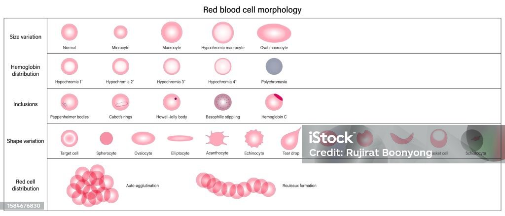 Vetores de Morfologia Das Hemácias Variação De Tamanho Hemoglobina