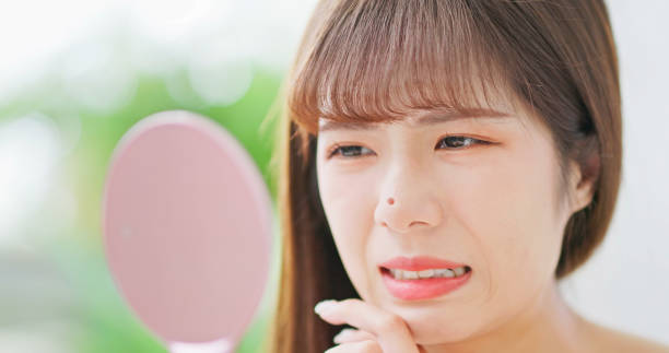 istock woman with pimple 1585178565