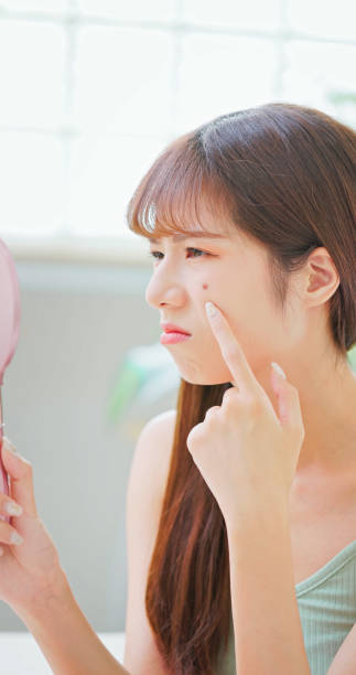 istock woman with pimple 1585179636