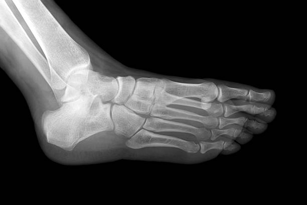 radiografia del piede sinistro - anklebone foto e immagini stock