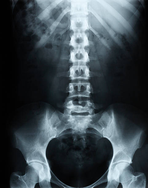 spina dorsale umana a raggi x - phase image mri scan science nobody foto e immagini stock