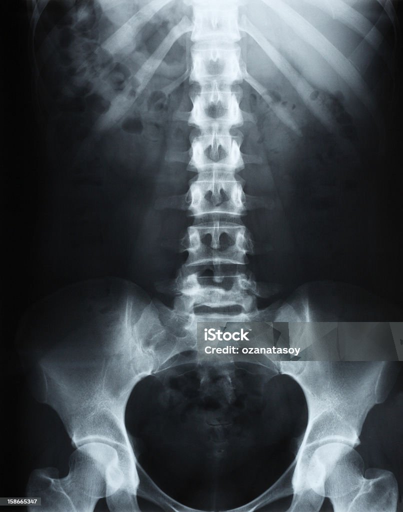 Ludzki kręgosłup w X-Ray - Zbiór zdjęć royalty-free (Zdjęcie rentgenowskie)