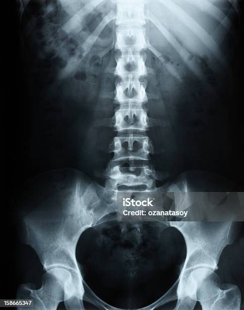 Ludzki Kręgosłup W Xray - zdjęcia stockowe i więcej obrazów Zdjęcie rentgenowskie - Zdjęcie rentgenowskie, Rentgen, Anatomia człowieka