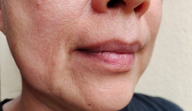 istock The flabbiness and wrinkle on the face. 1586790456