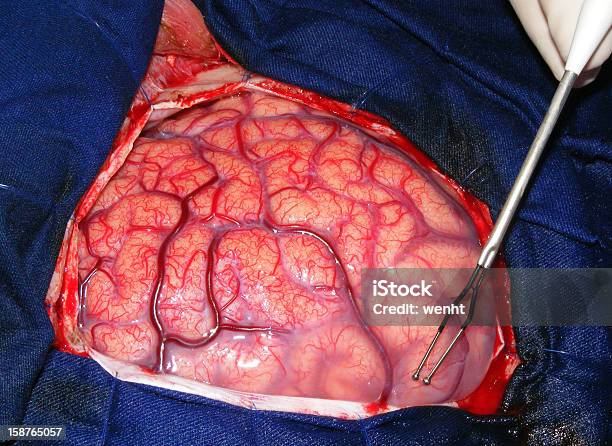 Neurosurgery 건강관리와 의술에 대한 스톡 사진 및 기타 이미지 - 건강관리와 의술, 고랑, 뇌이랑