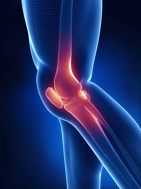 Knee pain in xray look stock photo