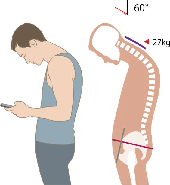Vector illustration of Neck angle and load when looking at a smartphone, tilt 60 degrees