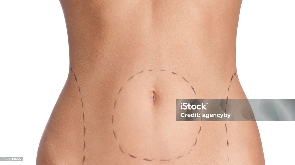 correction en plastique du ventre - Photo de Abdomen libre de droits