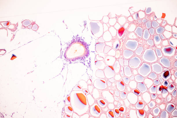 istock Thyroid gland and Thymus gland human Child under the microscope for education in the laboratory. 1589188203