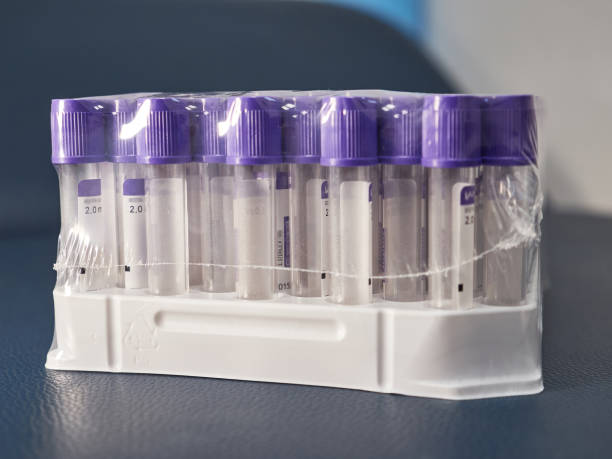 istock Test tubes for collecting, storing and transporting blood. Laboratory blood tests. 1589398022