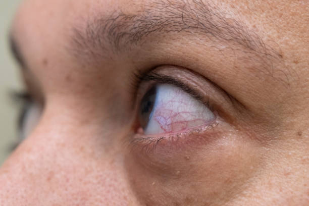 istock capillary and muscular human eye 1589648413
