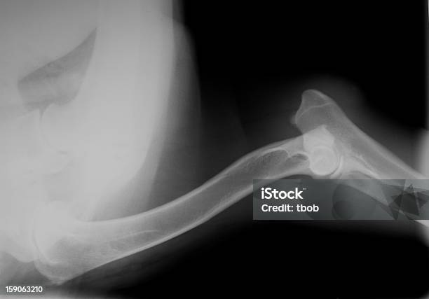 Xray Of Dog Schultern Und Ellenbogen Stockfoto und mehr Bilder von Röntgenbild - Röntgenbild, Medizinisches Röntgenbild, Hund