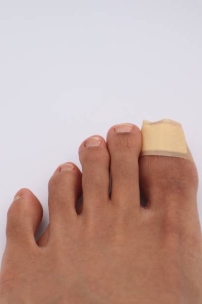 istock Close-up of foot with bandaid 1591209965