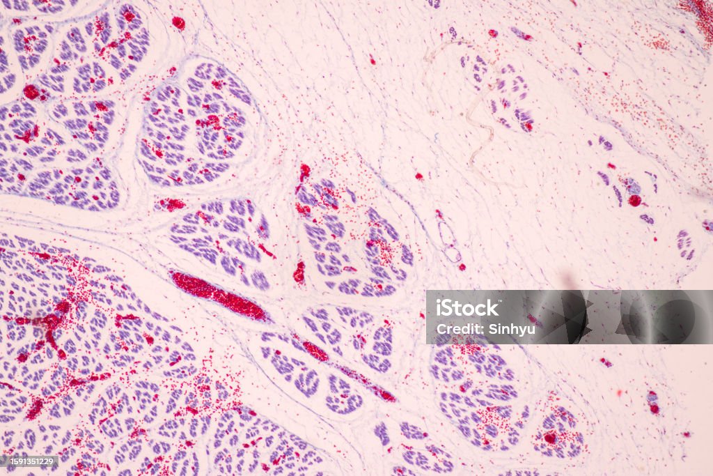 Parathyroid Micrograph Trachea Thymus Parathyroid Gland And Tonsil Human Under The Microscope ...