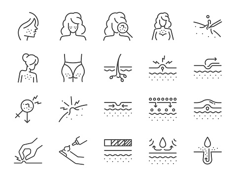 Acne icon set. It included pimple, facial, zits, inflammation and more icons. Editable Vector Stroke.