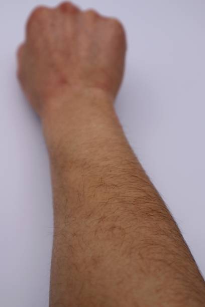 Close-up photo of a man's hairy arm