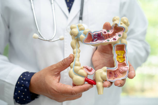 istock Intestine, appendix and digestive system, doctor holding anatomy model for study diagnosis and treatment in hospital. 1598629615
