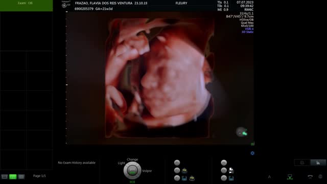 Ultrasound scan of body of fetus or baby during pregnancy