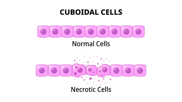 Cuboidal Cells - Normal Cell - Necrotic Cell Cuboidal Cells - Normal Cell - Necrotic Cell - Medical Vector Illustration cuboidal epithelium stock illustrations