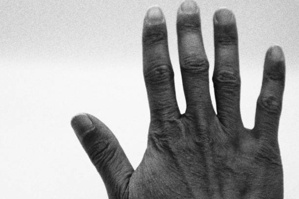 Photo of person with dry skin
